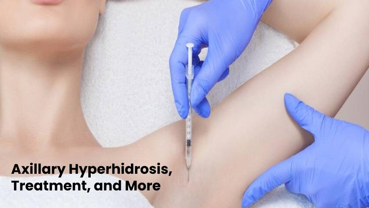 Axillary Hyperhidrosis, Treatment, and More