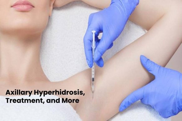 Axillary Hyperhidrosis, Treatment, and More