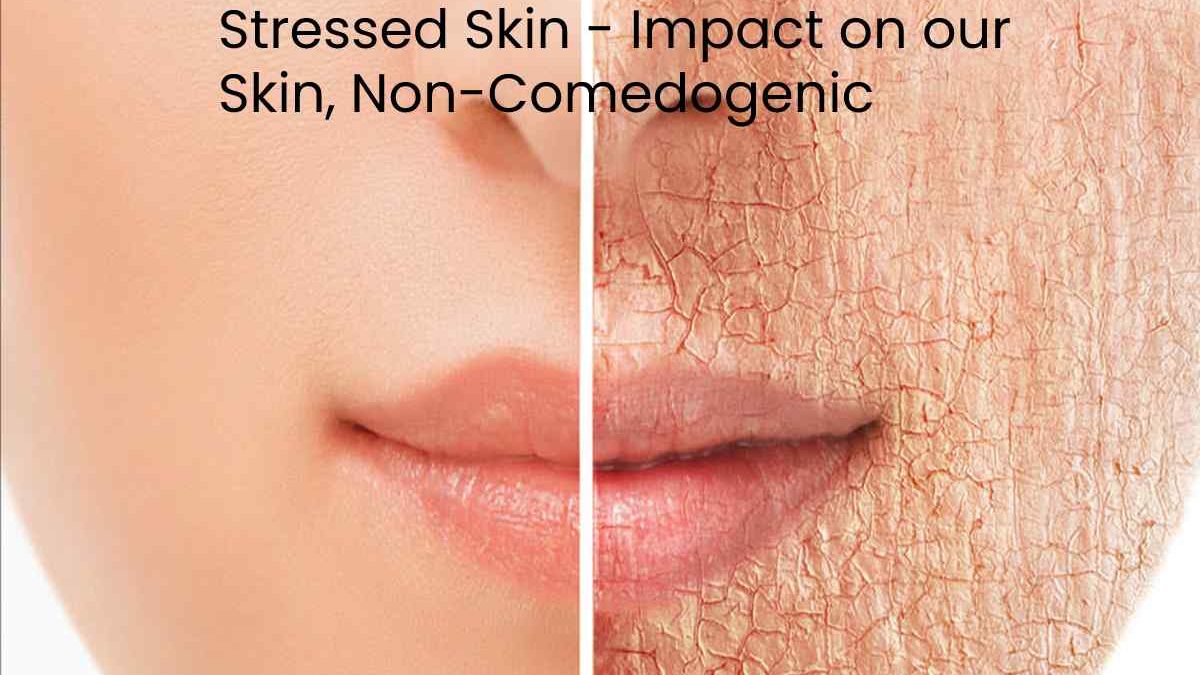 Stressed Skin – Impact on our Skin, Non-Comedogenic, and More