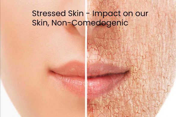 Stressed Skin