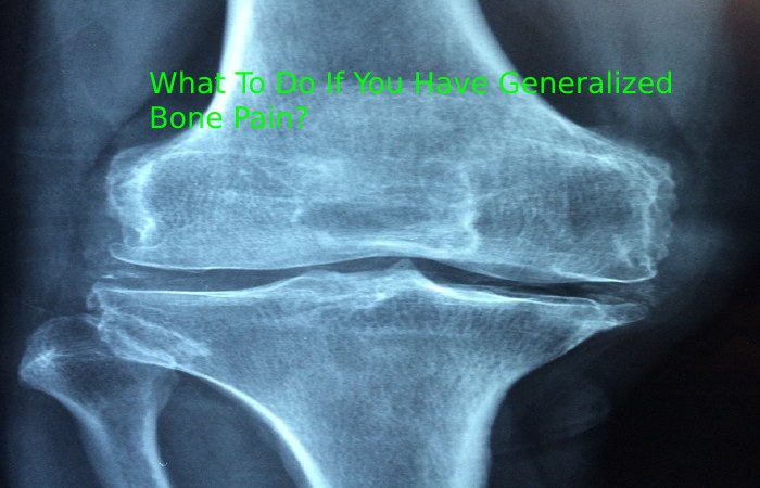 What To Do If You Have Generalized Bone Pain
