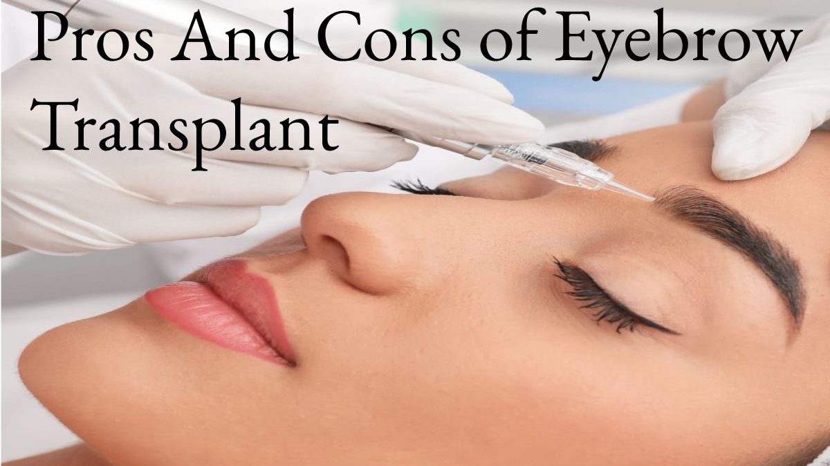 Pros And Cons of Eyebrow Transplant