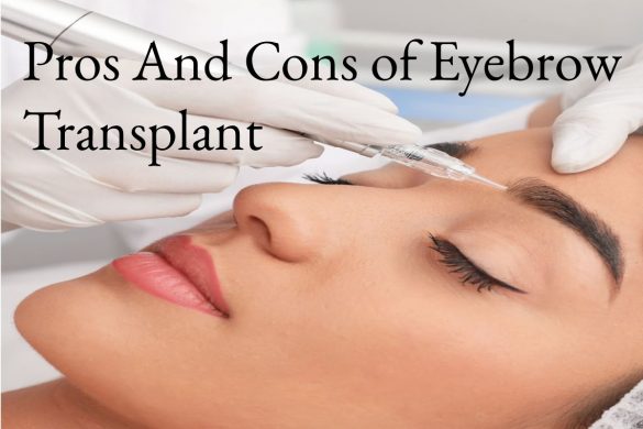 Pros And Cons of Eyebrow Transplant