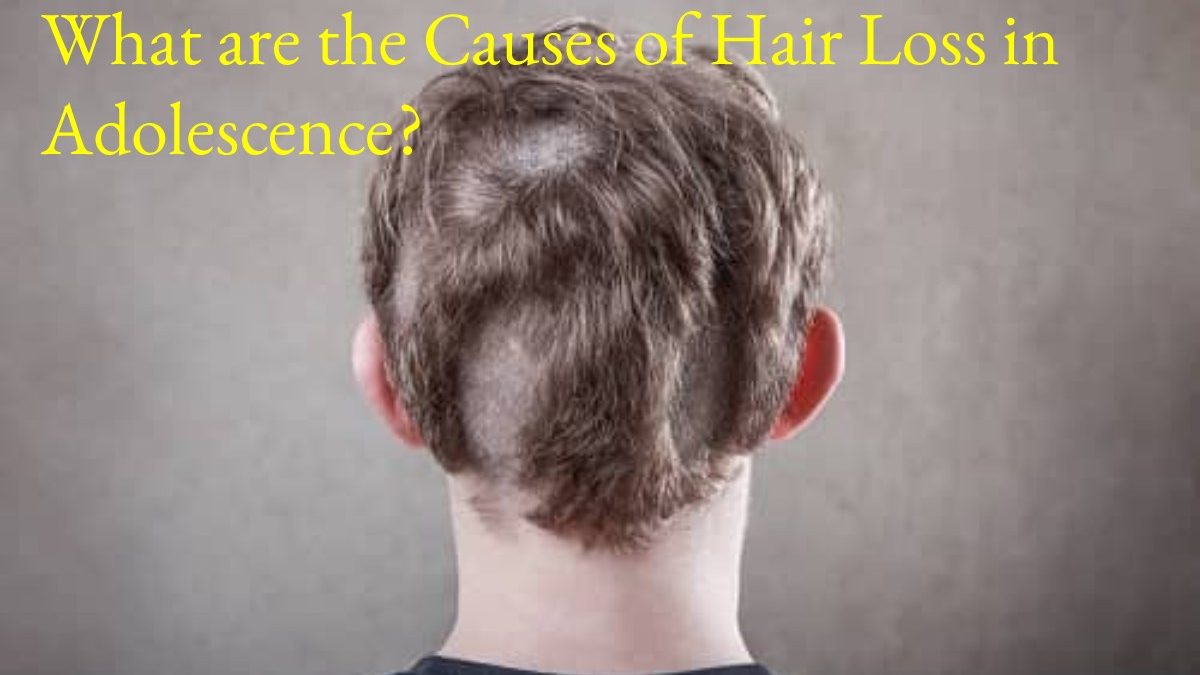 What are the Causes of Hair Loss in Adolescence?